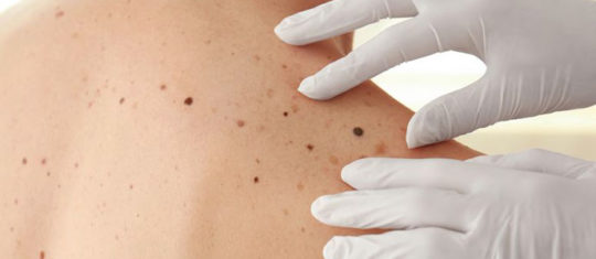 dermatologue